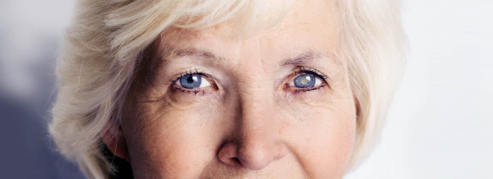Cataract Surgery in Murrysville